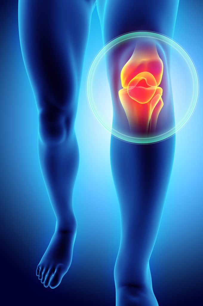Knee Pain - Forest Hills - Physical Therapy - Rehabilitation - Queens, NY