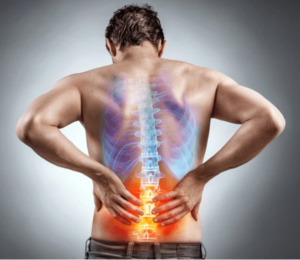 back pain - physical therapy - forest hills, queens